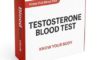 Testosterone Blood Test: Essential Guide for Sheffield Residents