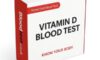 Vitamin D Blood Test Insights for Health in Grimsby